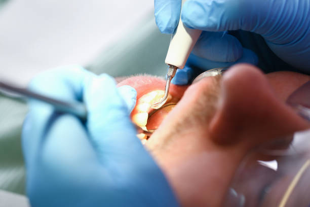 Best After-Hours Emergency Dentist in South Riding, VA